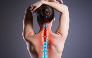 cervical spine injuries woman's neck