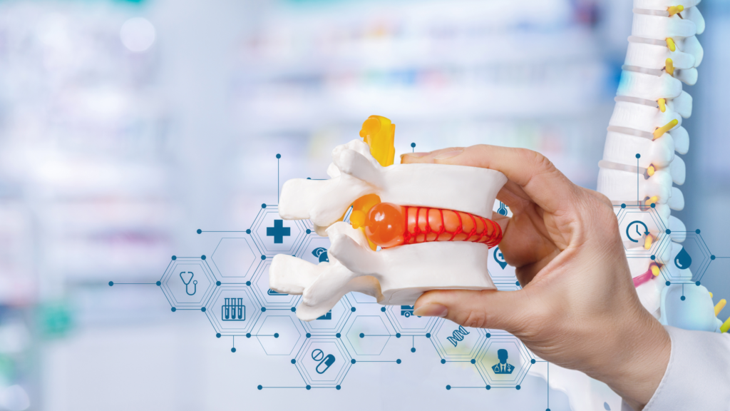 Discogenic Pain Things to Know First State Spine