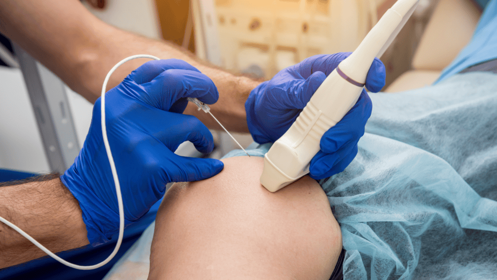 How Does Radiofrequency Ablation Treat Chronic Pain? First State Spine